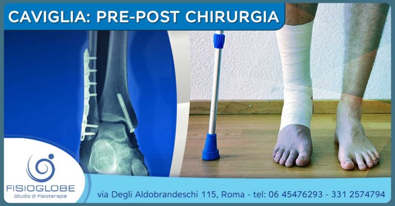 Pre post chirurgia caviglia