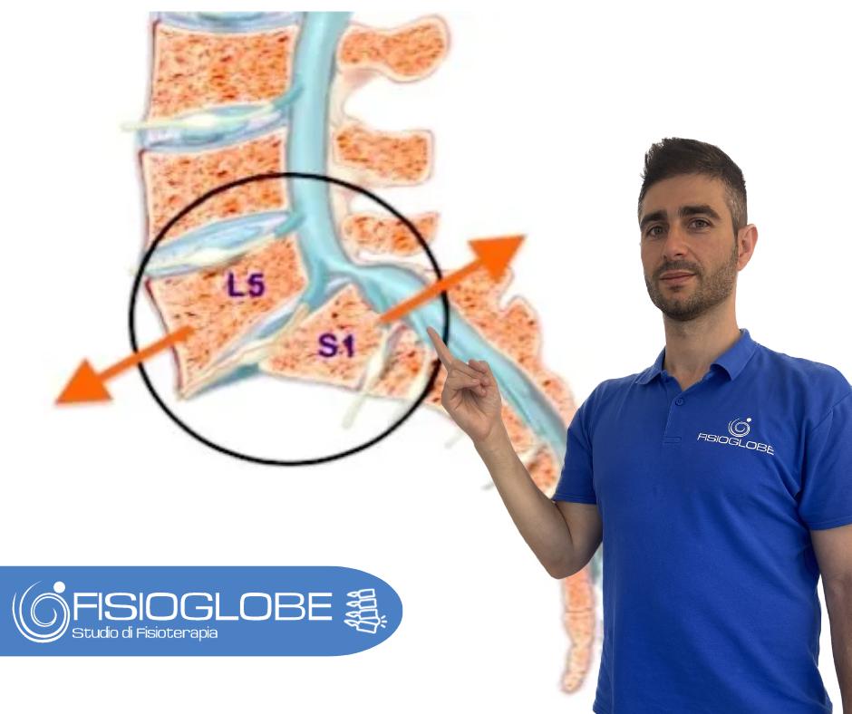 Spondilolistesi: cause, sintomi e rimedi
