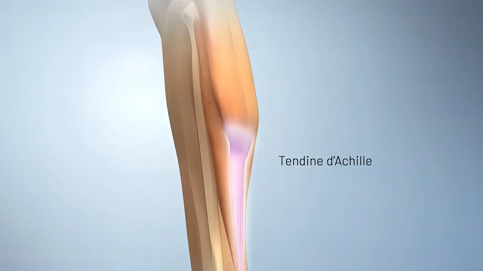 tendine d'achille