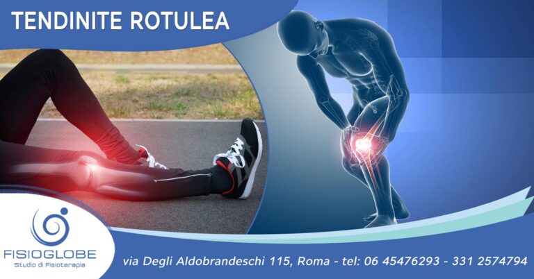tendinite rotulea