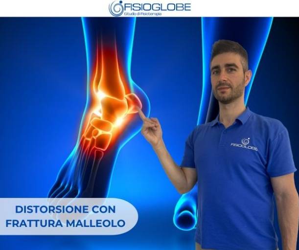 Distorsione con frattura del malleolo