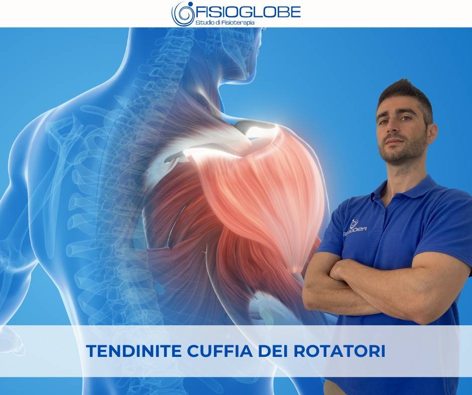 Tendinite della cuffia dei rotatori: come riconoscerla e cosa fare subito