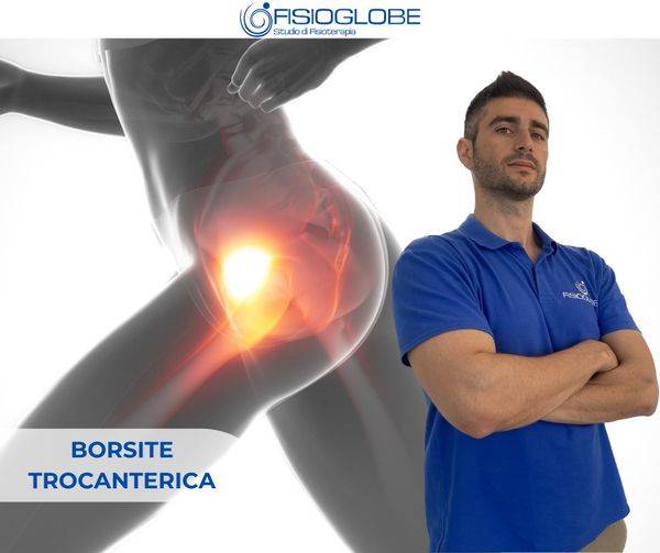 Borsite trocanterica, un dolore all'anca che non va ignorato