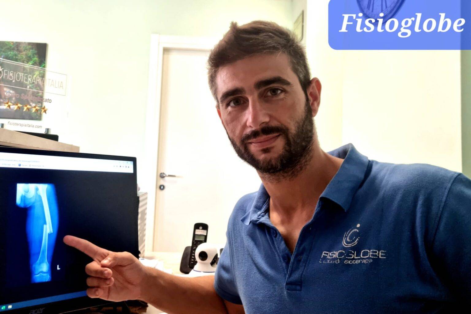 Riabilitazione per la frattura del femore