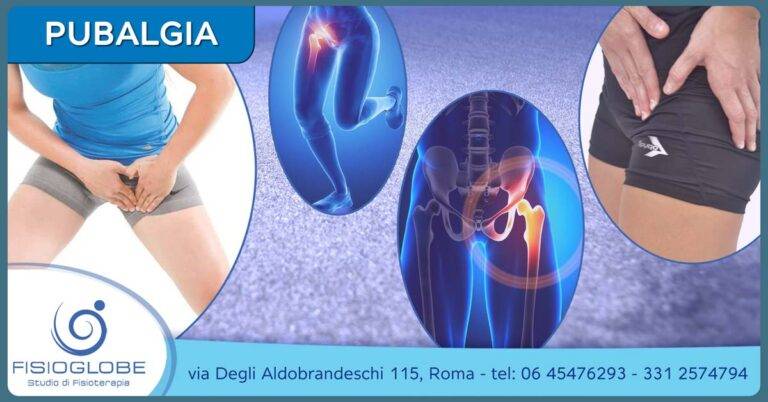 pubalgia