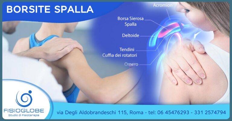 Borsite alla spalla