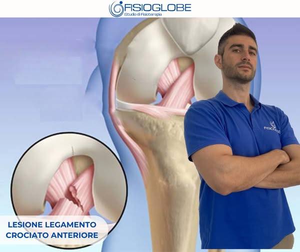 Lesione al legamento crociato anteriore: cosa fare per un recupero efficace